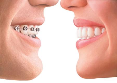 Orthodontie - Wijnegem